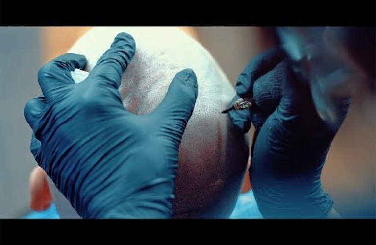 La tricopigmentation, c'est quoi ?
