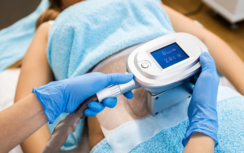 soins cryolipolyse franchise beauté